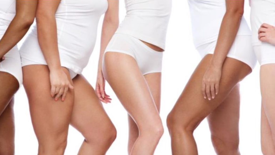 Alerte aux varices : 5 facteurs de risque à surveiller